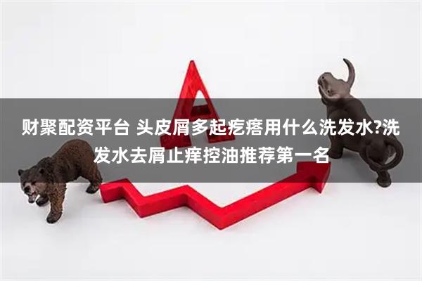 财聚配资平台 头皮屑多起疙瘩用什么洗发水?洗发水去屑止痒控油推荐第一名